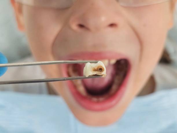 Best Orthodontic Emergency Dentist in La Cresta, CA